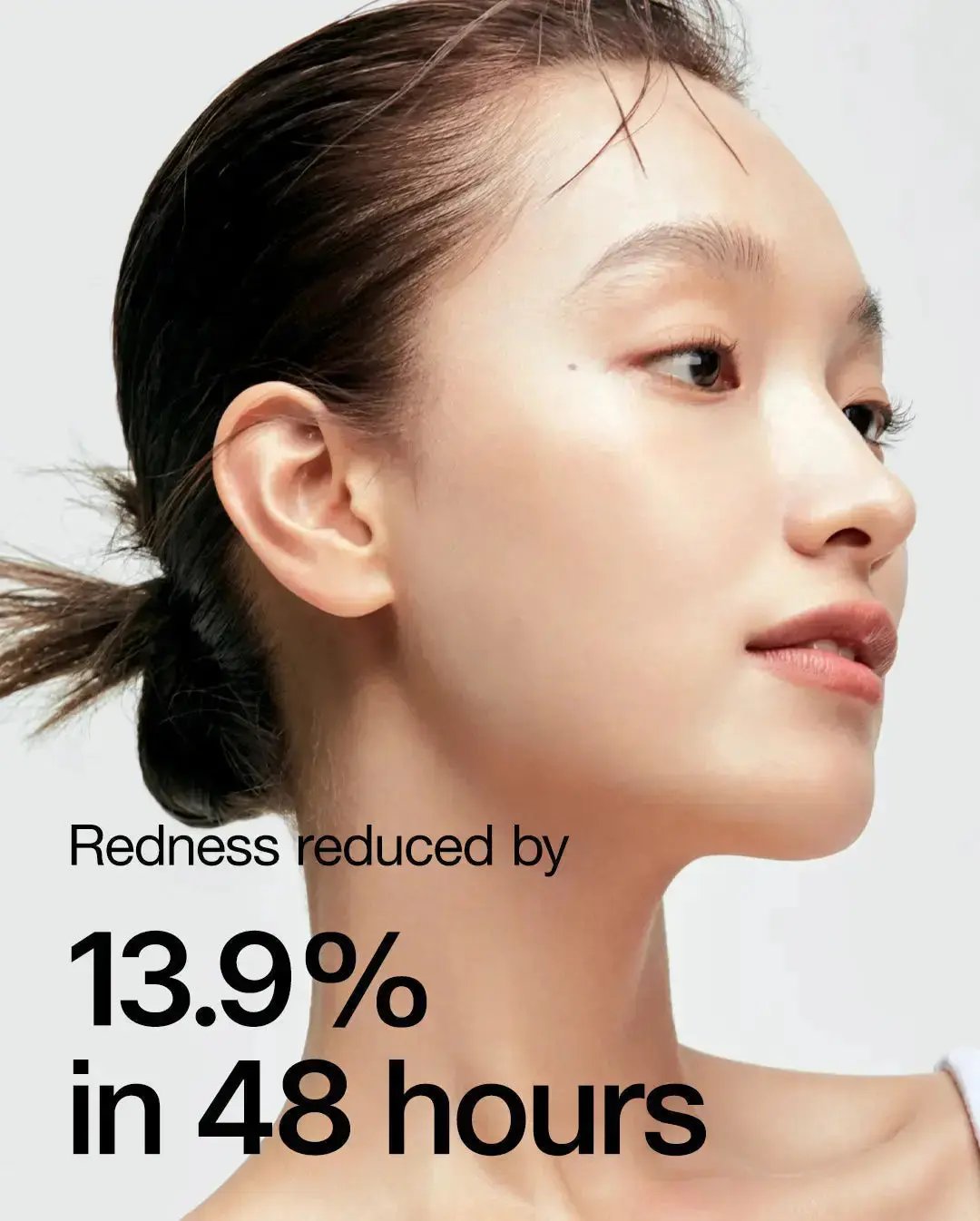 Anua Heartleaf 77% Soothing Toner 250 ml ANUA