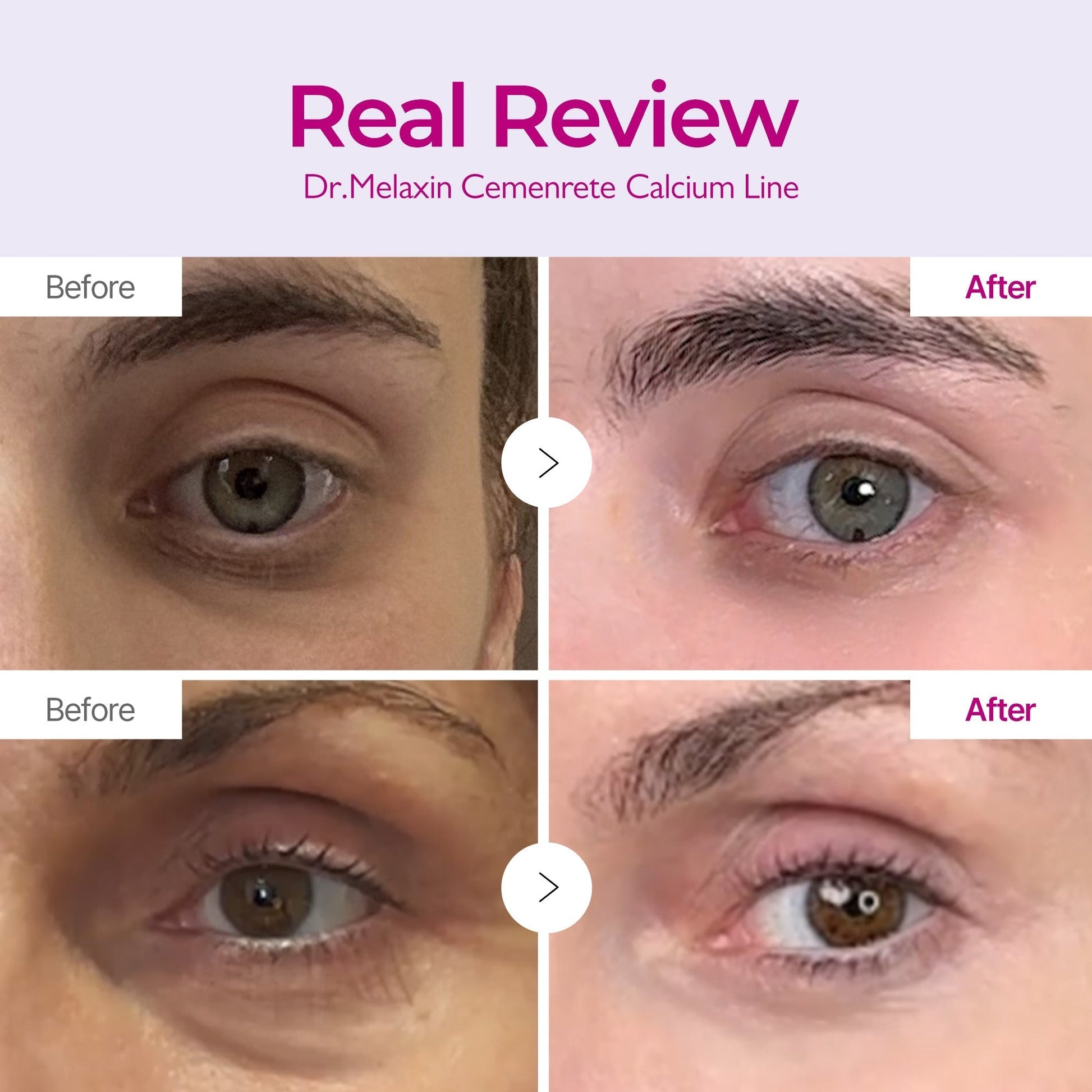 Dr.Melaxin Calcium Eyecare Routine Set Dr.Melaxin