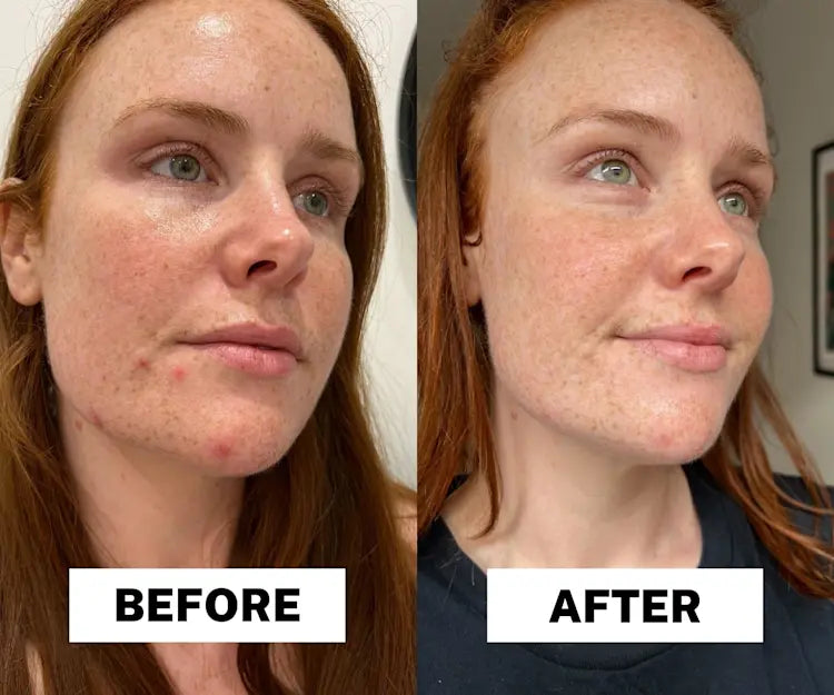 Dr.Melaxin Radiant Glow Duo Peeling Kit Dr.Melaxin