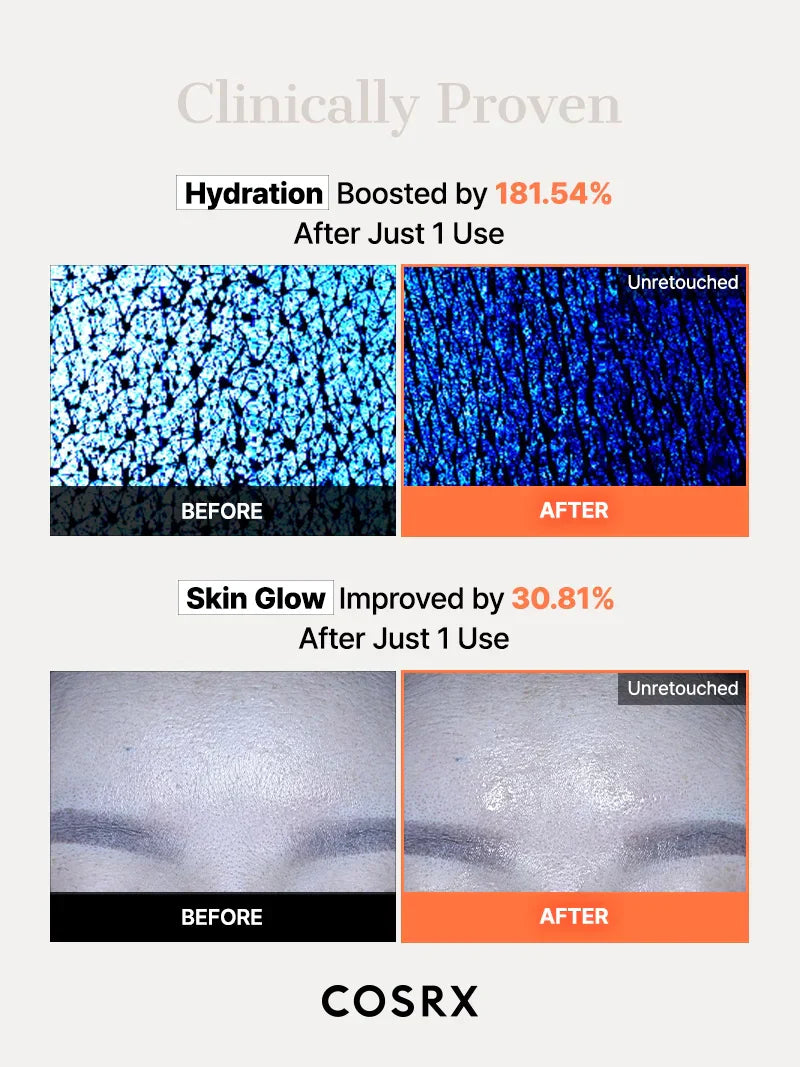 COSRX 5 PDRN Hyaluronic Acid Vital Hydrating Hydrogel Mask spread on skin, showcasing its refreshing, hydrating gel texture.