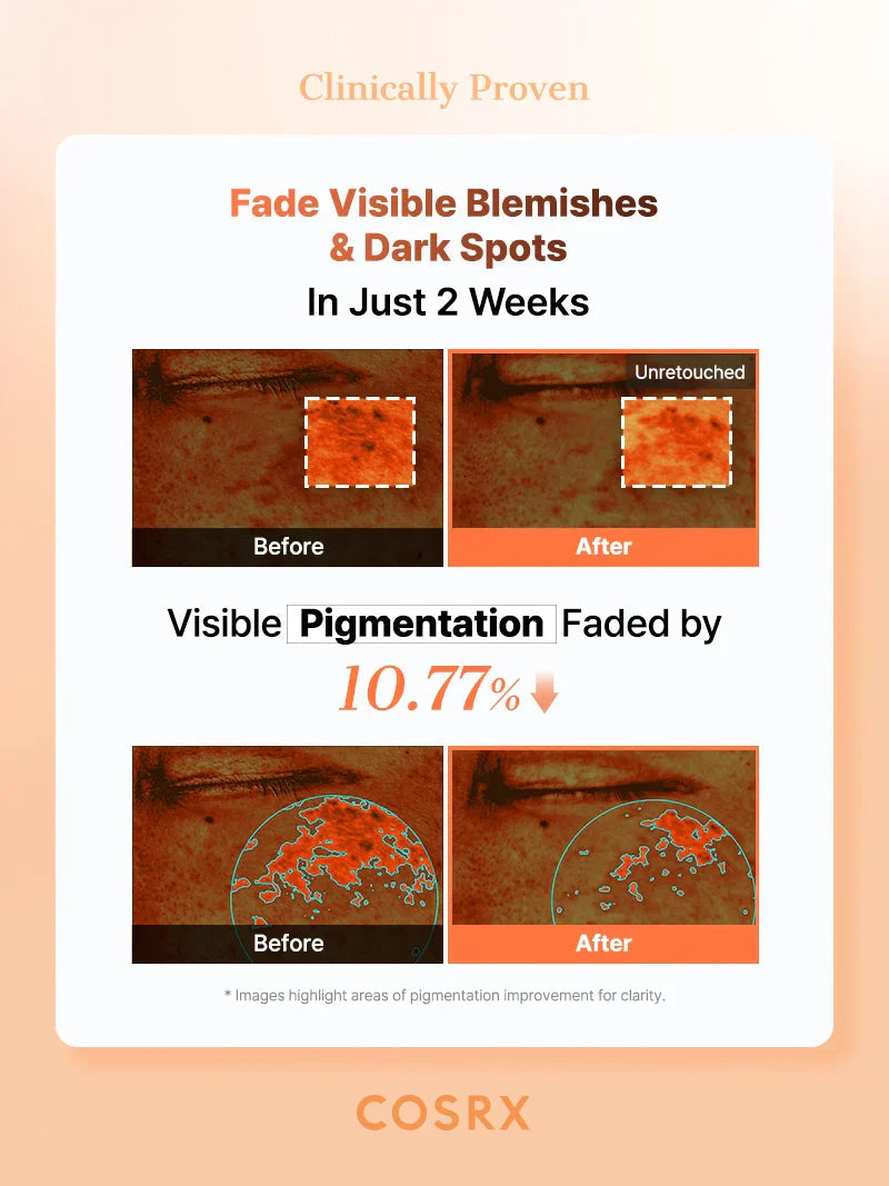 COSRX 5 PDRN Hyaluronic Acid Vital Hydrating Hydrogel Mask COSRX