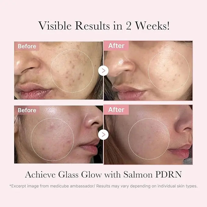 MEDICUBE PDRN Glow Kit Medicube