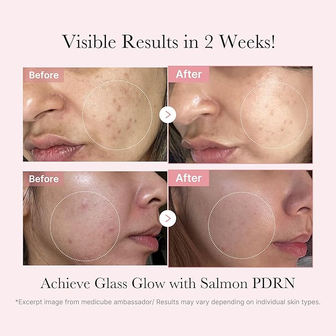 Medicube PDRN Glow Kit skincare set with serum and cream, featuring sleek packaging and glowing skin on model's hand.