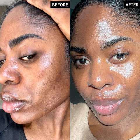 Dr.Melaxin Radiant Glow Duo Peeling Kit Dr.Melaxin