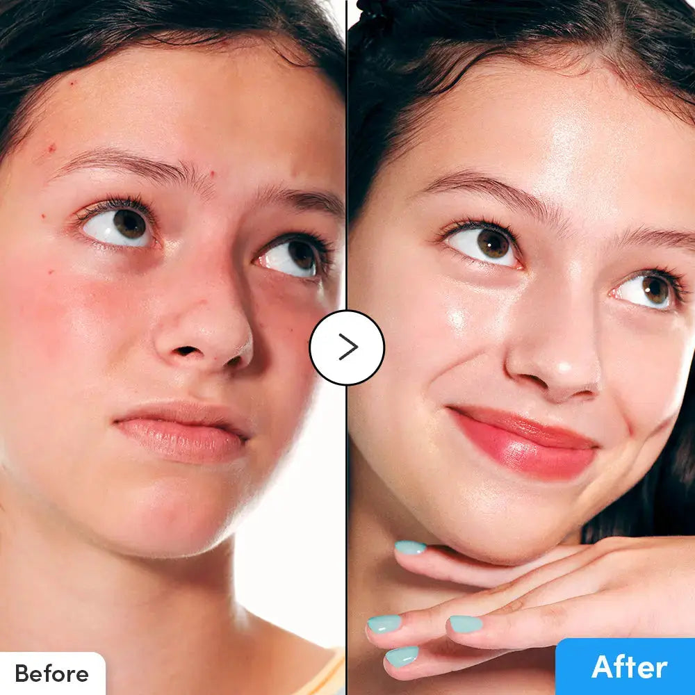 EQQUALBERRY Blue Blow Hyaltoin Flooding Serum 30ml EQQUALBERRY