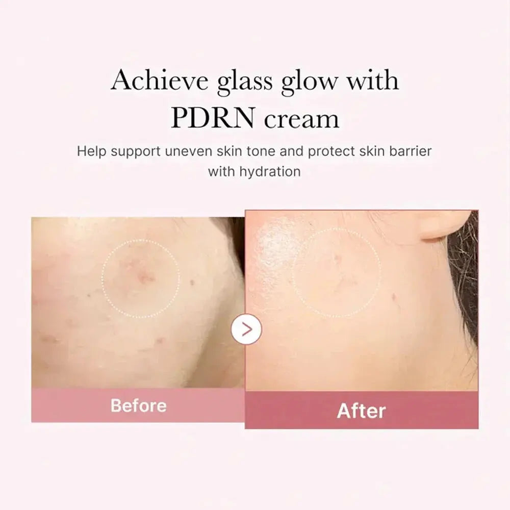 Medicube PDRN Pink Hyaluronic Moisturizing Cream in 50ml jar, featuring pink packaging and smooth cream texture.