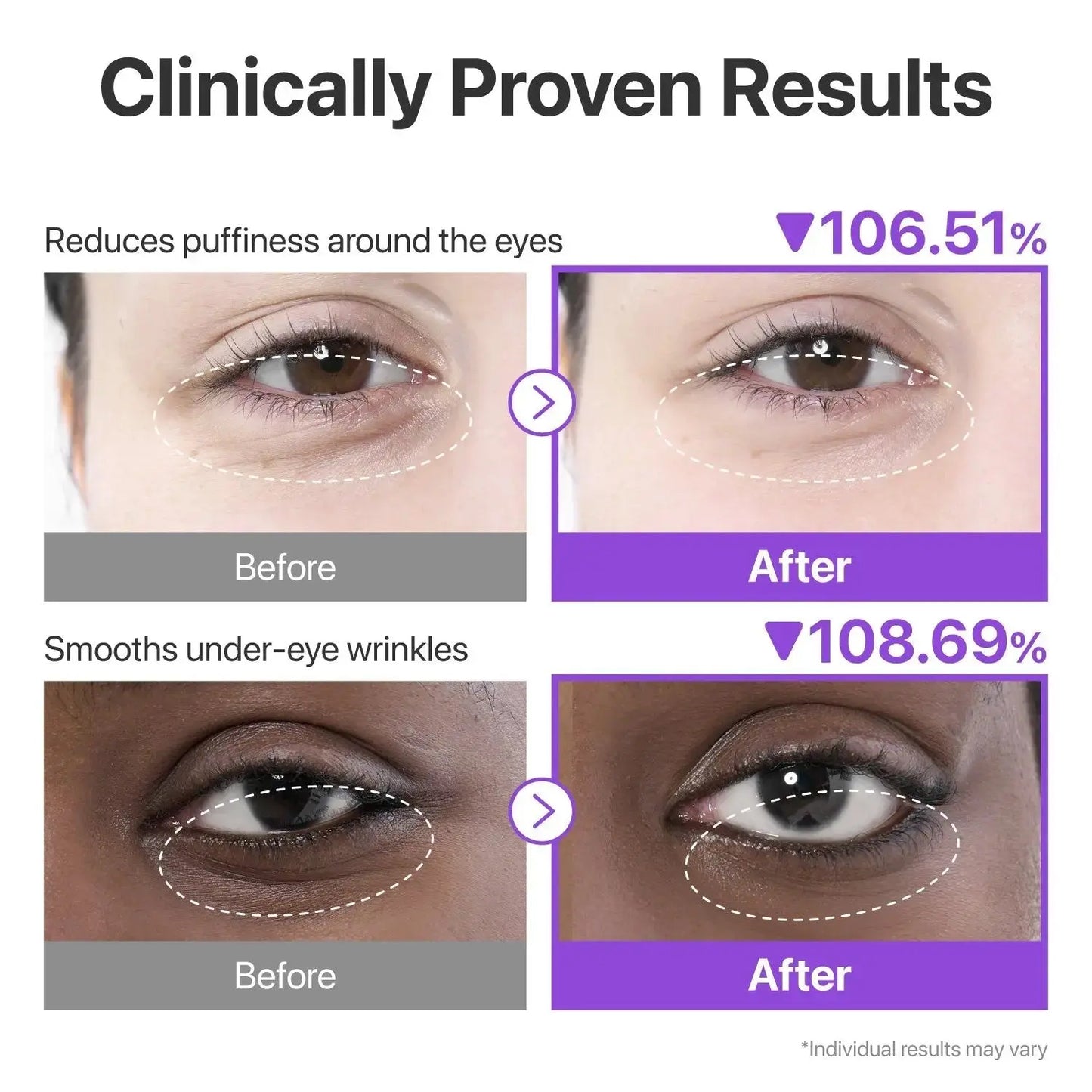 NUMBUZIN No.9 NAD+ Collagen Under Eye Patches (5 Pairs) numbuzin