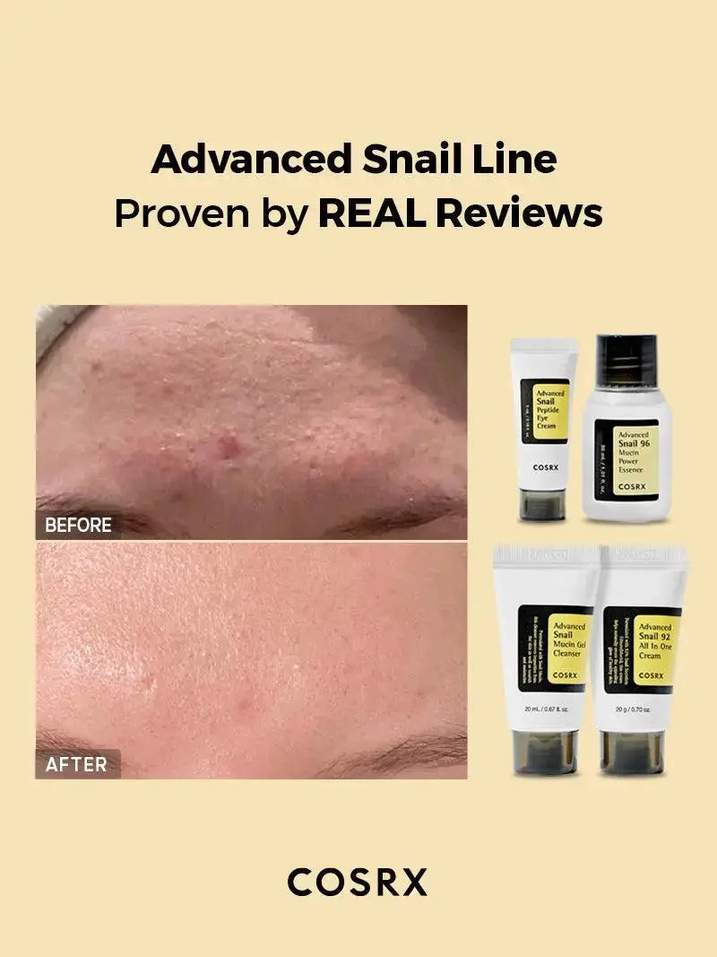 COSRX All About Snail 4-Step Kit with snail mucin skincare products in white and green packaging, designed for nourishing and repairing skin.