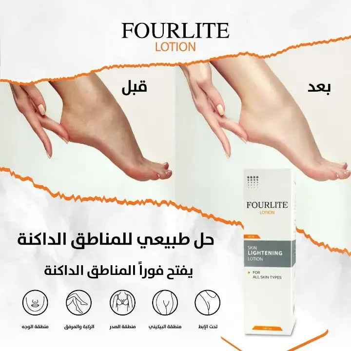 Fourlite Skin Lightening Lotion 100 ML