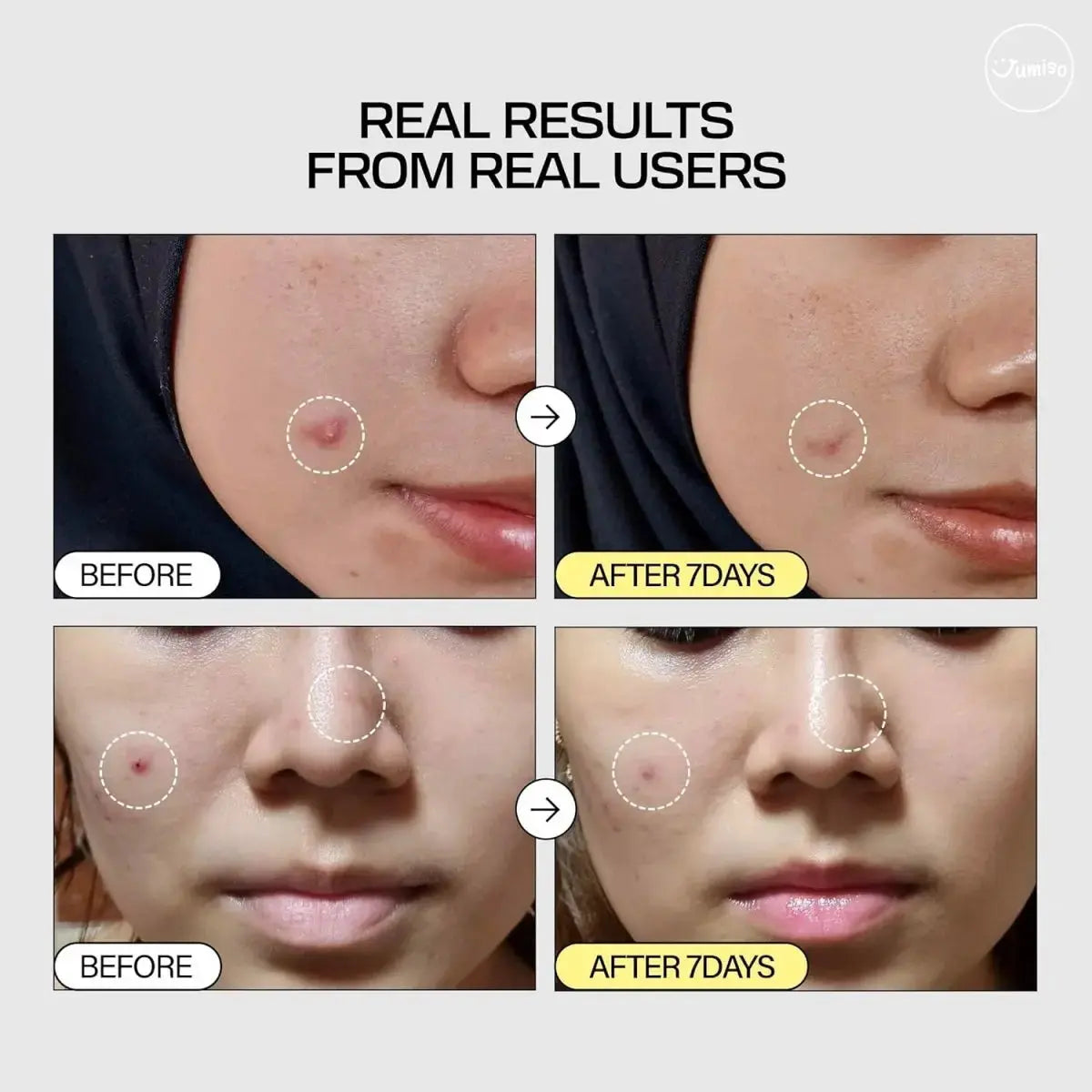JUMISO Snail Mucin 95 + Peptide Facial Essence 140ml bottle, clear liquid with a white cap, for nourishing skincare.