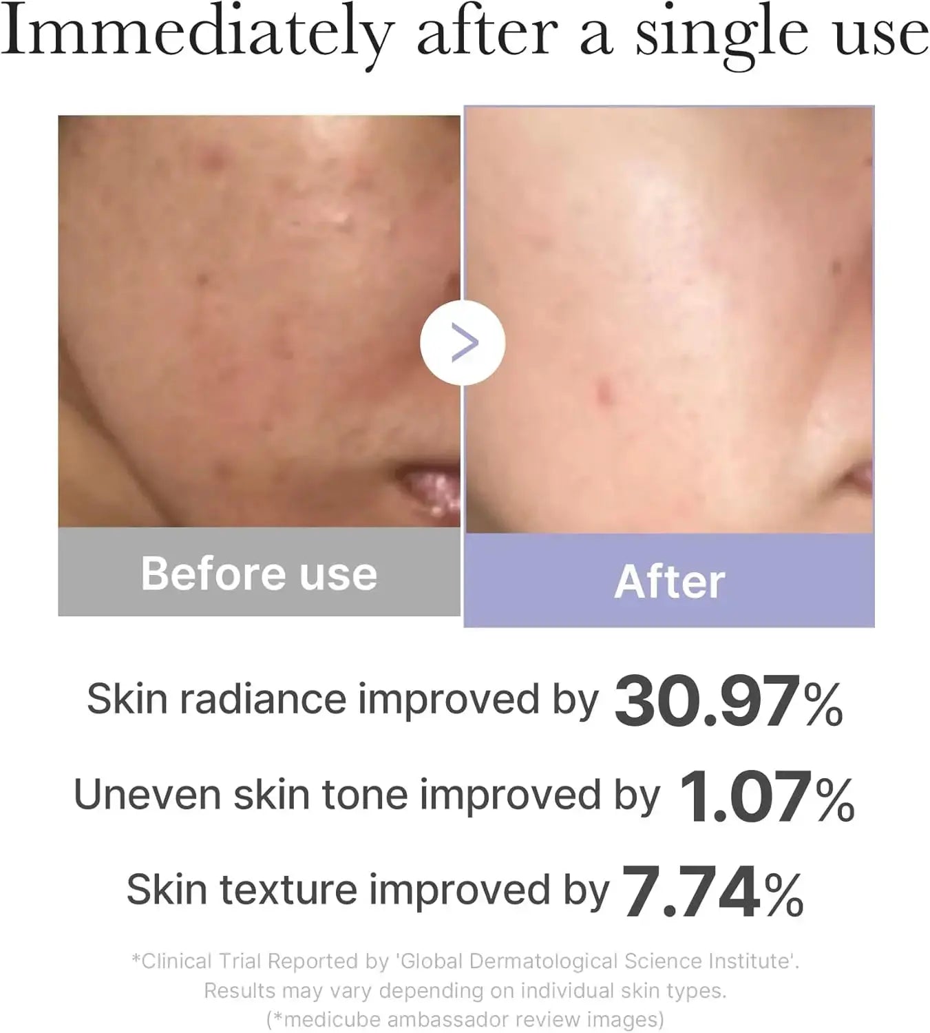 Medicube AGE R Booster Pro Mini in pink, close-up view of the compact skincare product with branding and product details visible.