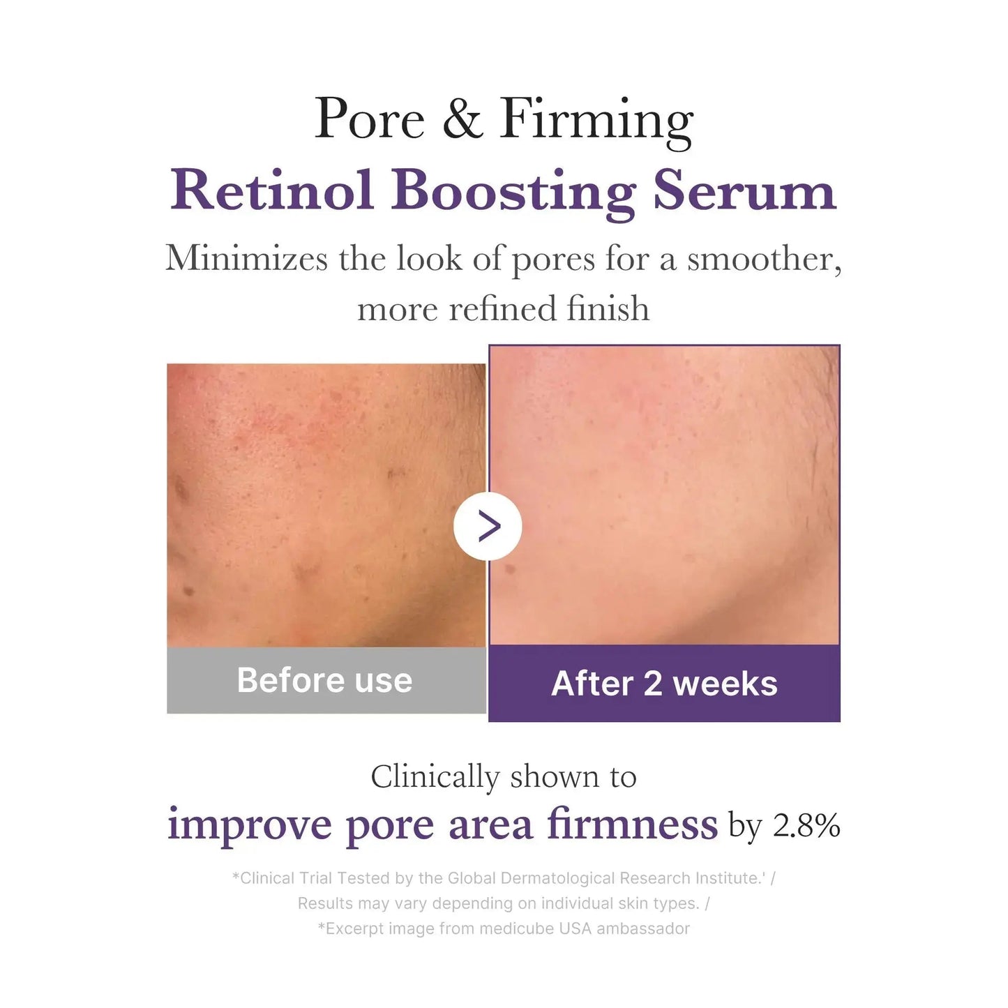 Medicube Retinol NMN Radiance Booster serum in a 30 ml bottle, featuring a clear dropper and sleek packaging.