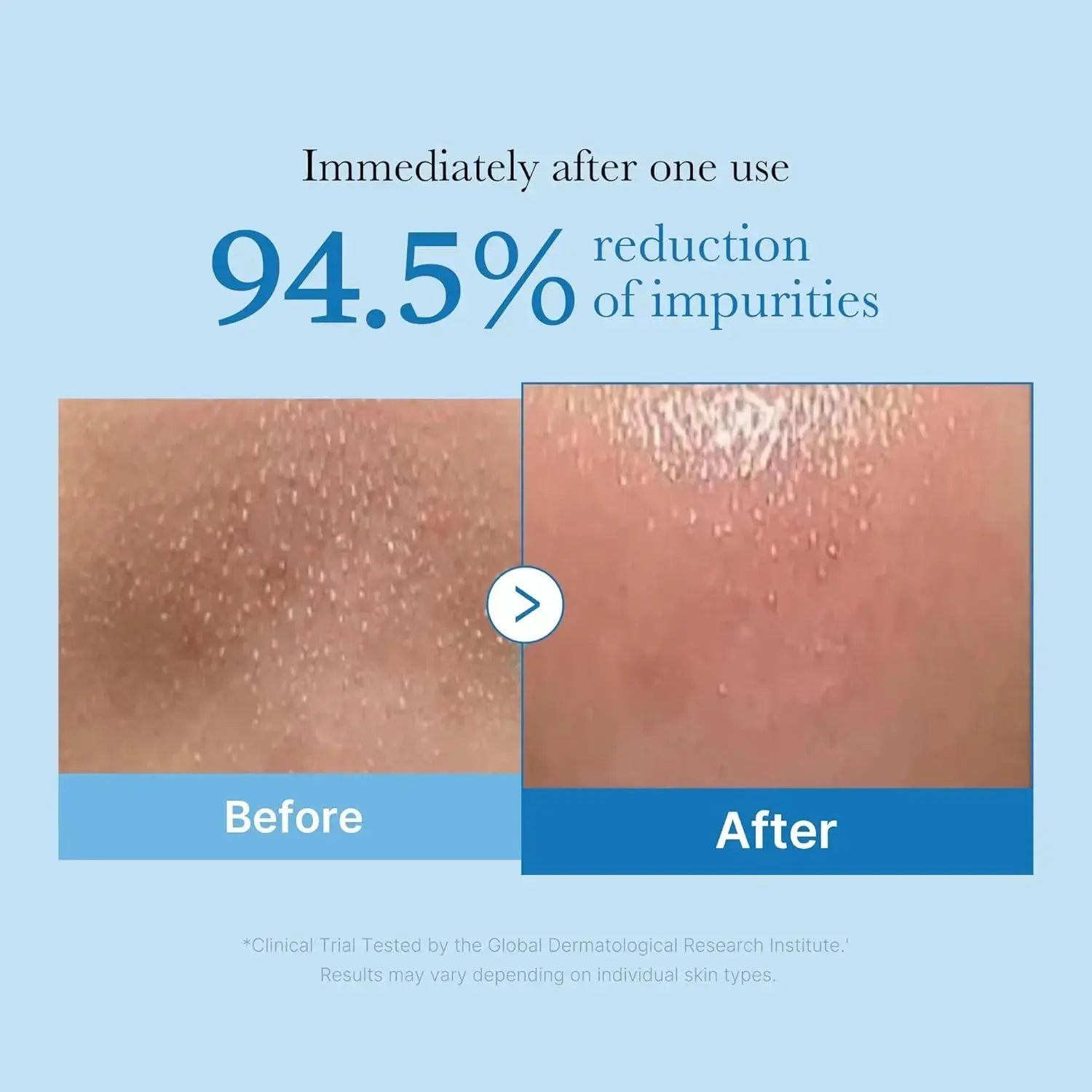 Medicube Zero Pore Blackhead Deep Cleansing Oil 205 ML bottle with pump dispenser and clear labeling.