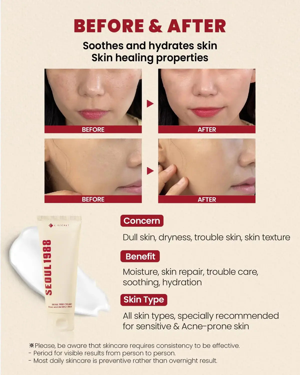 SEOUL 1988 Cream with 93% snail mucin and rice extract, 100ml jar, hydrating skincare product in a white and silver container.